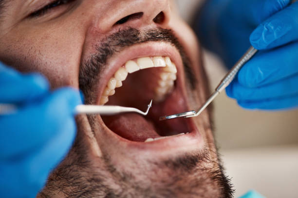 Best Laser Dentistry  in Adelphi, MD