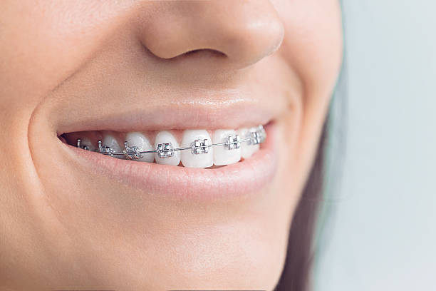 Best Veneers and Lumineers  in Adelphi, MD